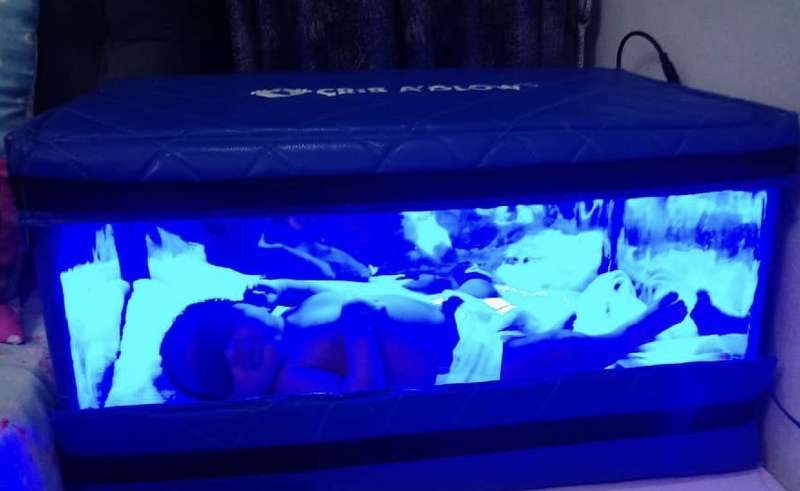 Baby in Electric Phototherapy Unit